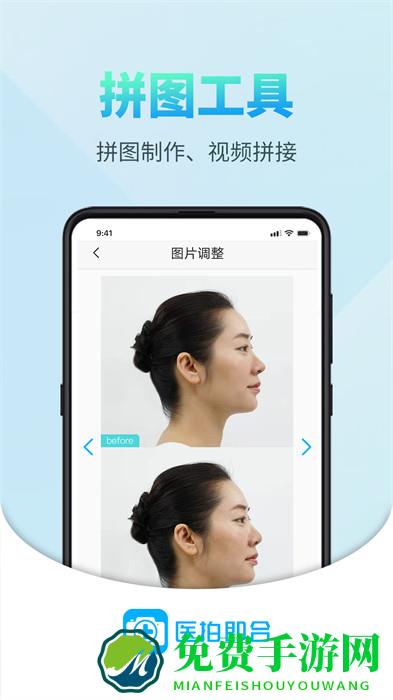医拍即合