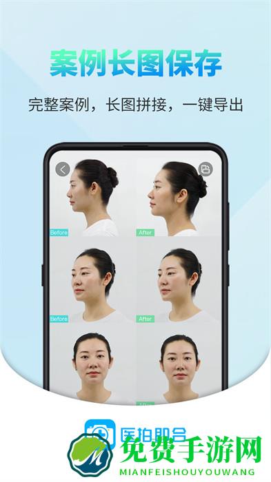医拍即合